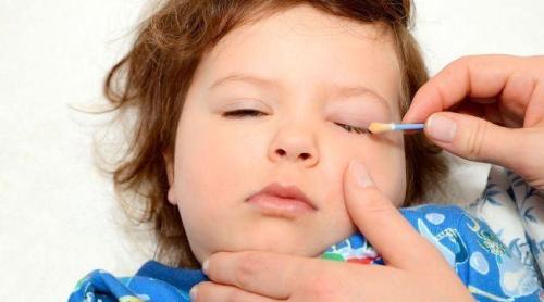 Tradiții și superstiții. Sfaturi băbești. Cum scapi de conjunctivită