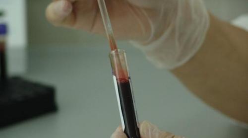 Testul de sânge care poate determina cu 8 luni înainte recidiva cancerului de sân